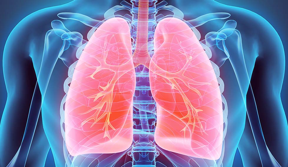 Rehabilitación pulmonar después del cáncer de pulmón
